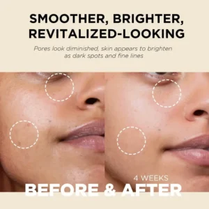 It’s Skin Retinoidin Cream 100ml
