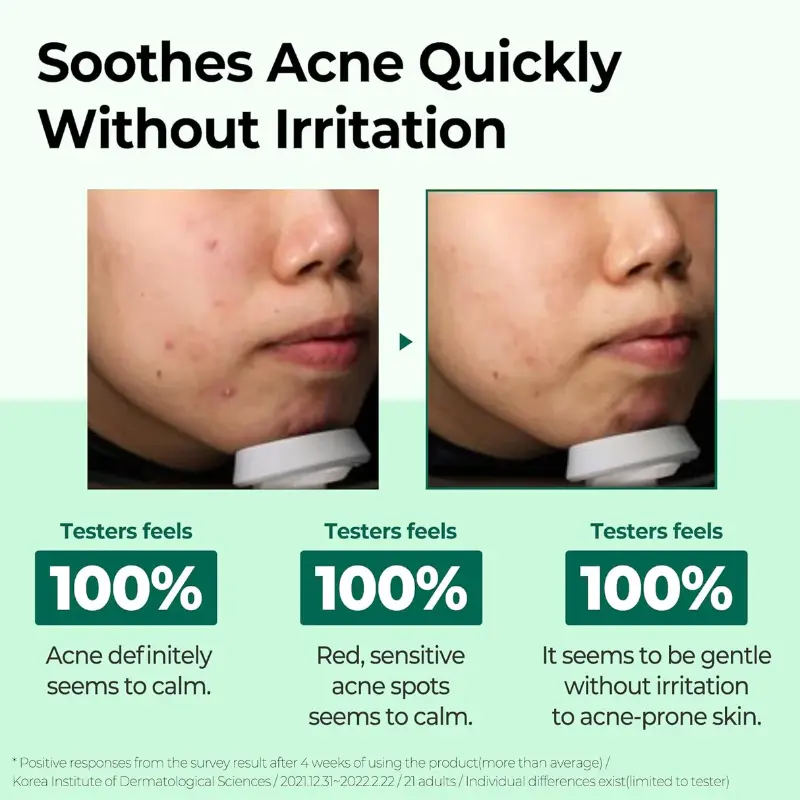 Some By Mi AHA BHA PHA 30 Days Miracle Cream 60gr - Image 2